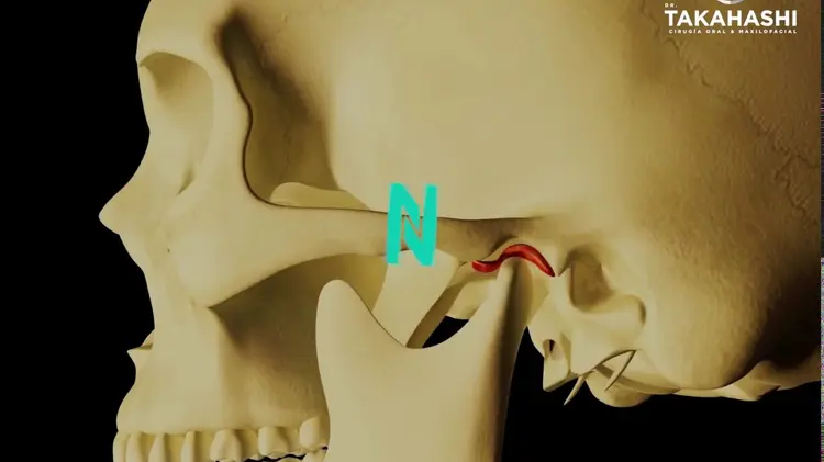 ¿Tu mandíbula truena? Podría tratarse de la disfunción temporomandibular